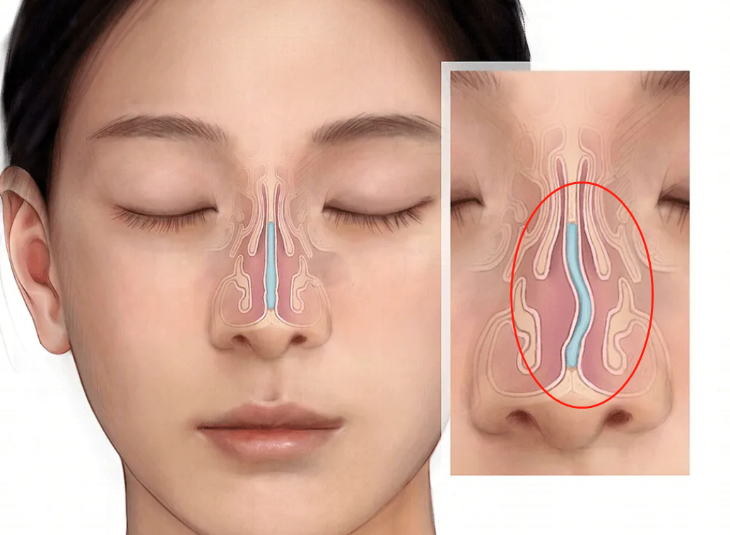 鼻腔手术小游戏攻略(关于鼻腔的小手术有哪些)