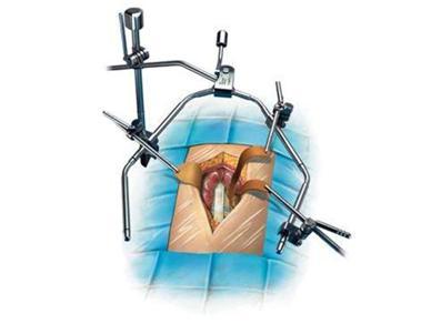 逃离手术室攻略(逃离手术室游戏视频)